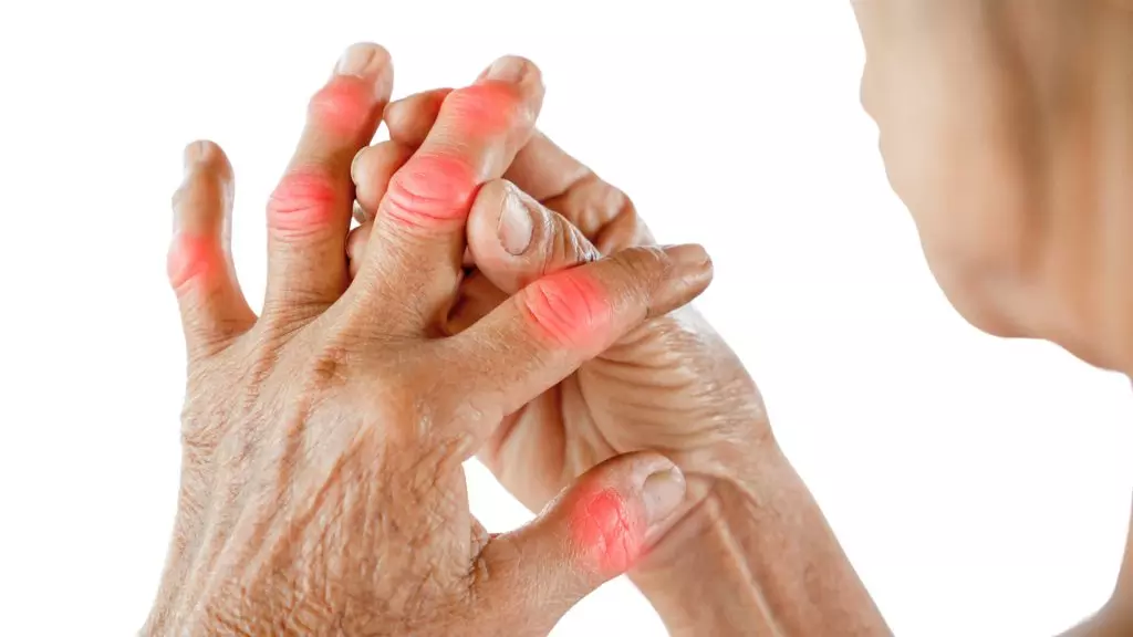 Is hydrogen water good for rheumatoid arthritis?